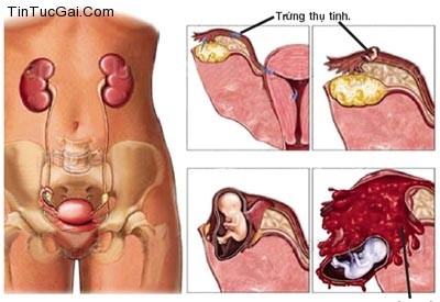 Chu kỳ kinh nguyệt và tác dụng phụ